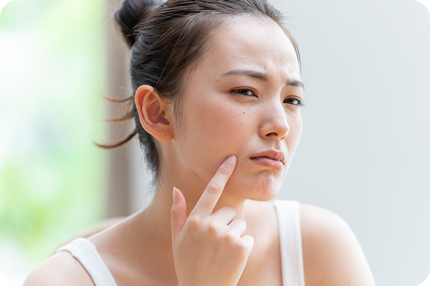 肌荒れを気にする女性