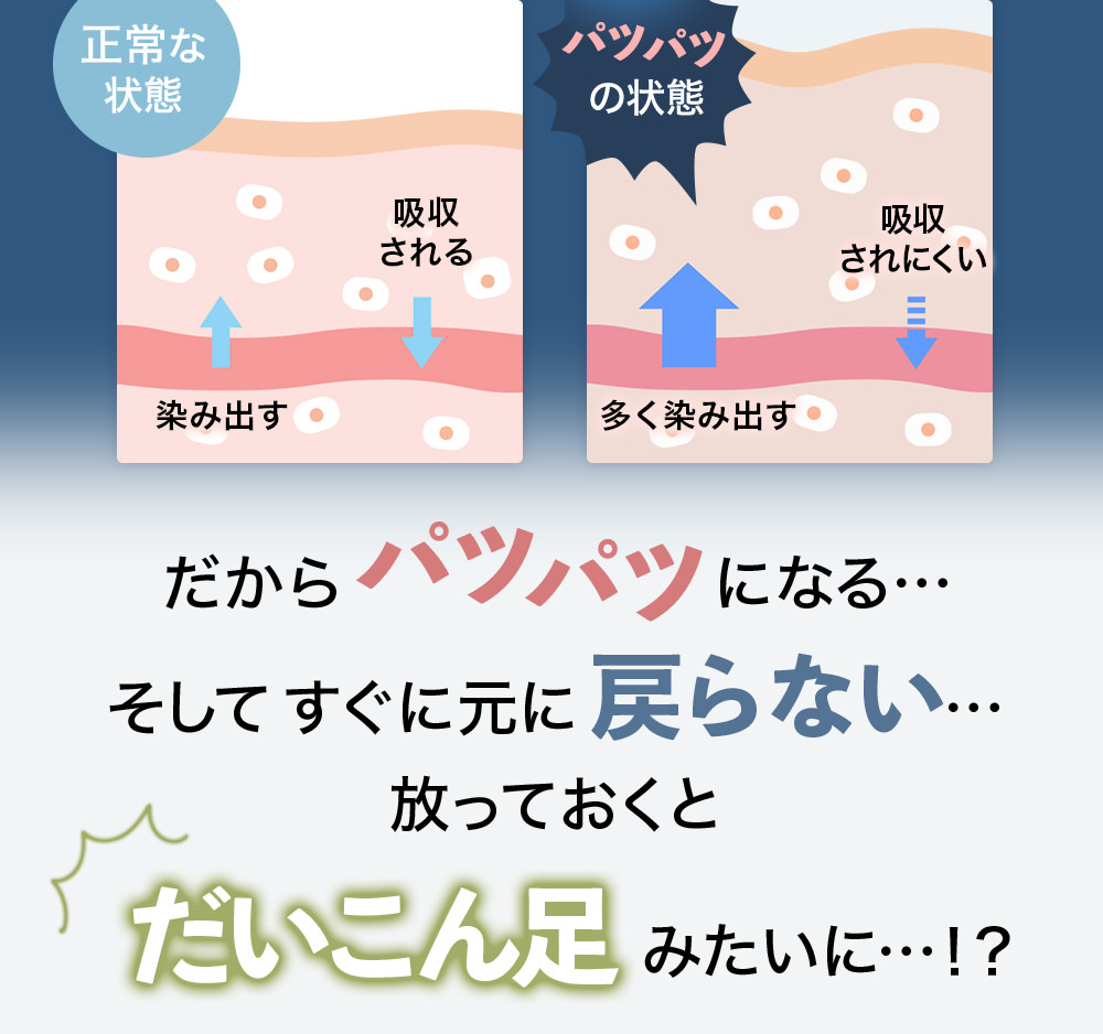 だからパツパツになる…そしてすぐに元に戻らない…放っておくとだいこん足みたいに…！？