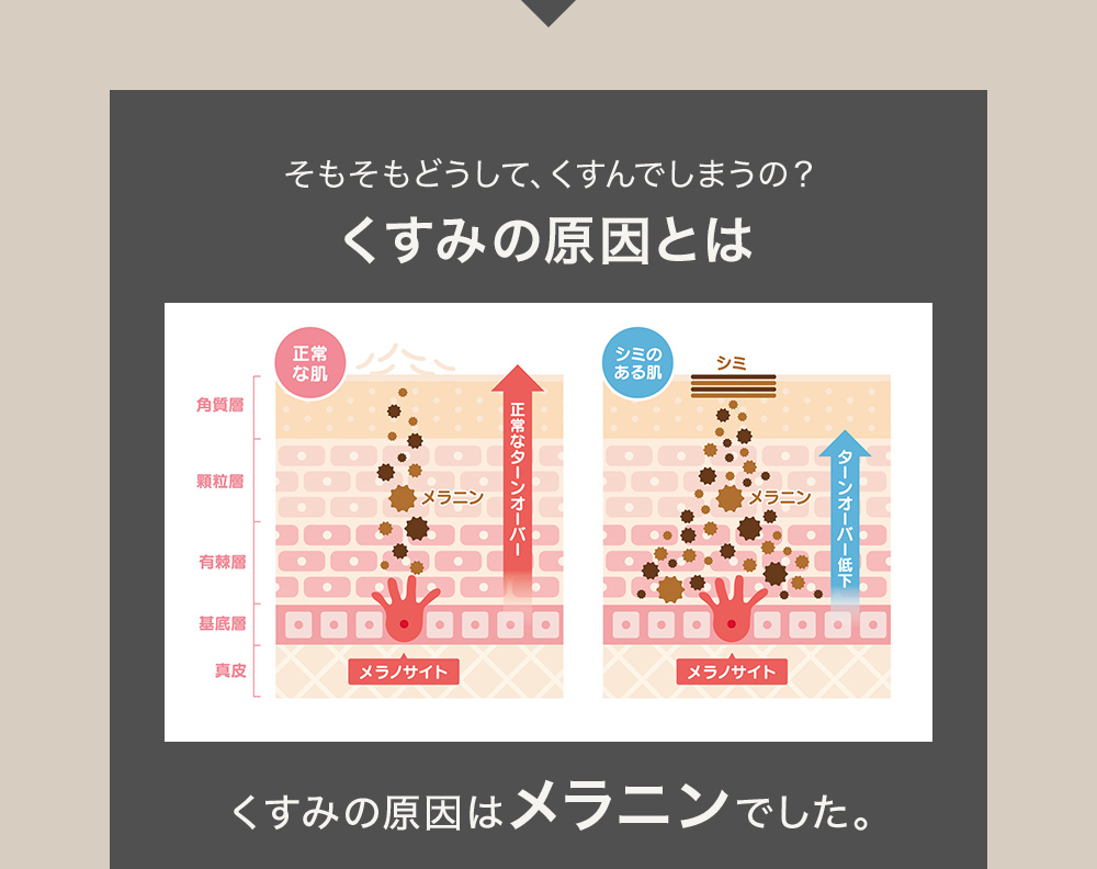 そもそもどうして、くすんでしまうの？くすみの原因とは くすみの原因はメラニンでした。