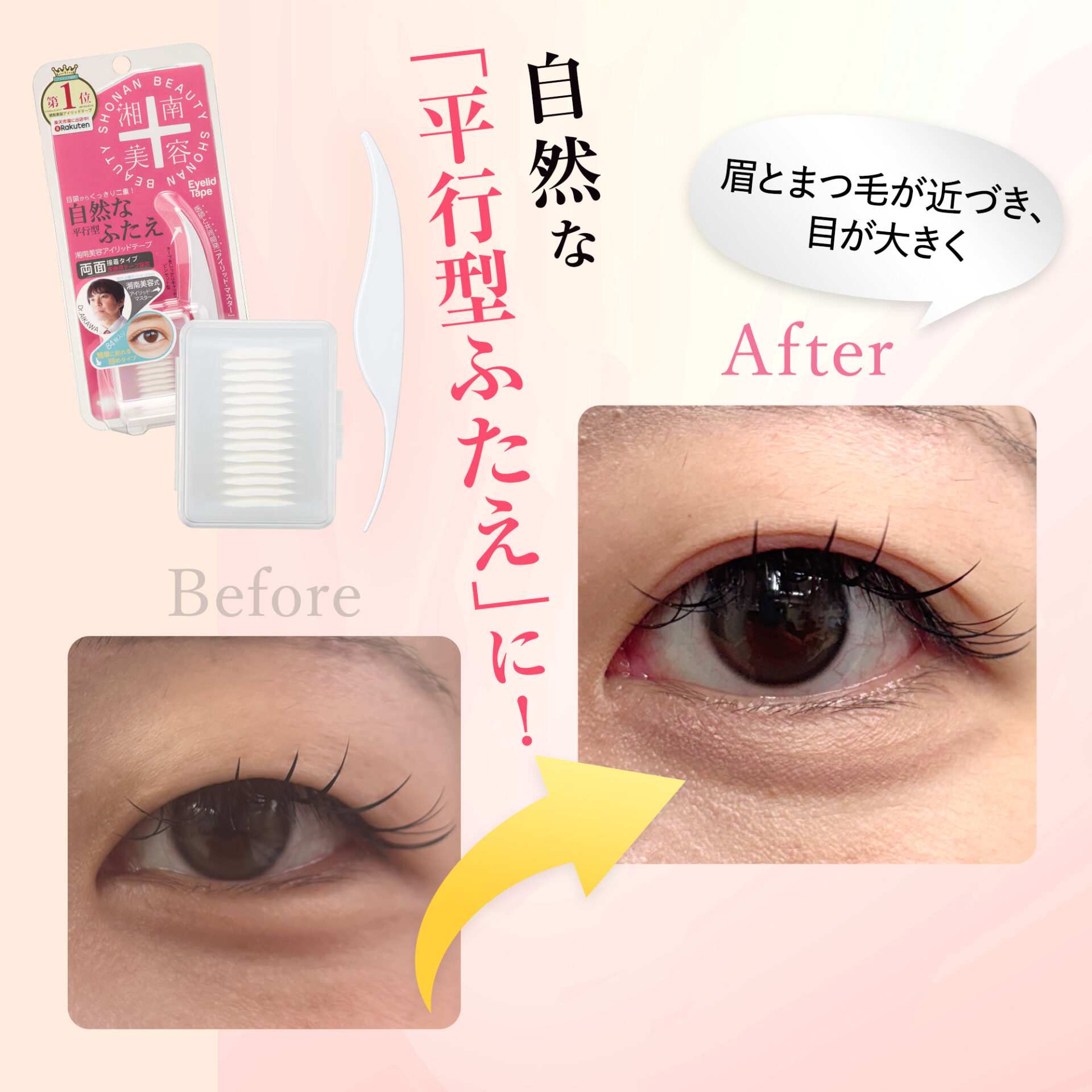 湘南美容アイリッドテープ（両面タイプ） - Co-medical+ 公式サイト