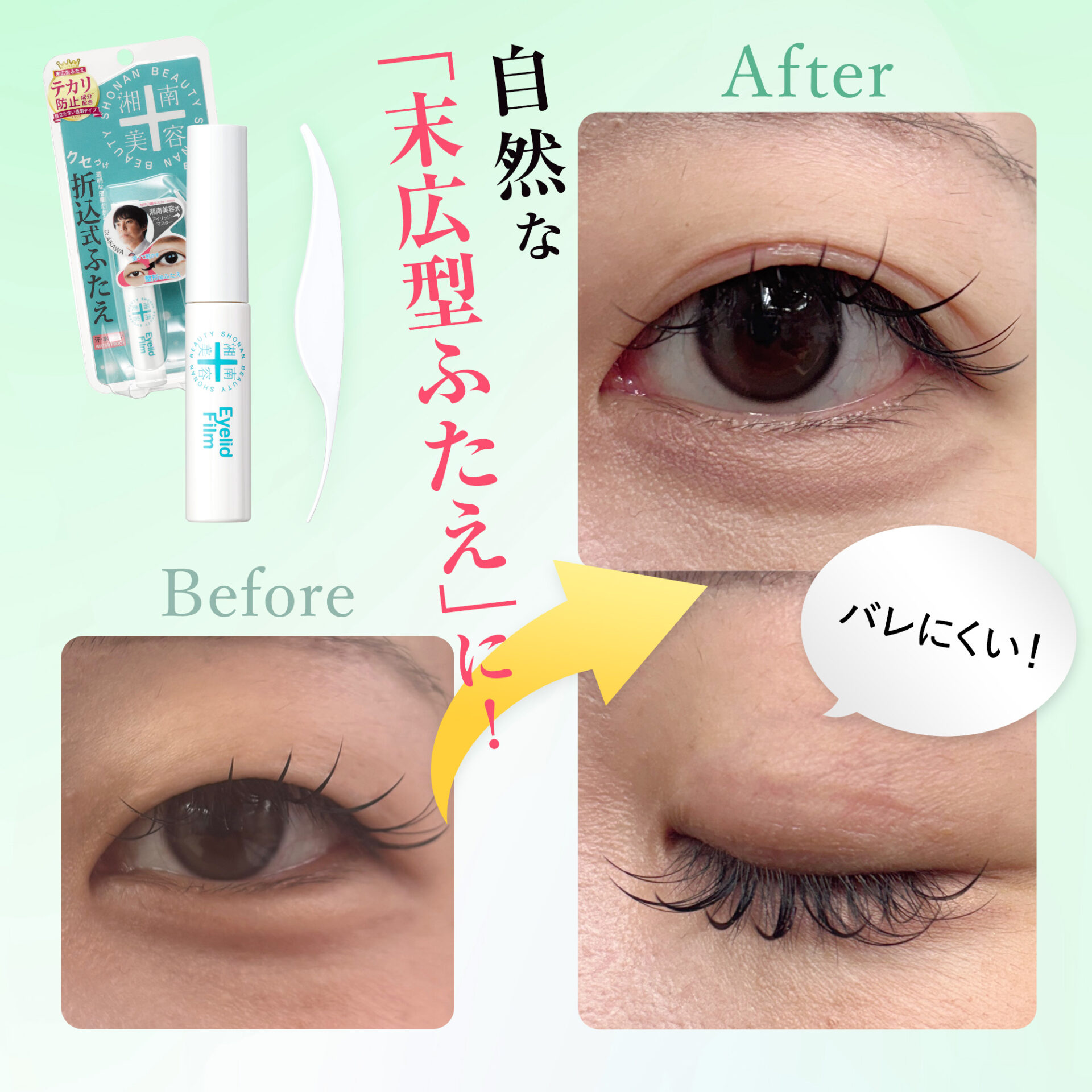 湘南美容アイリッドフィルム