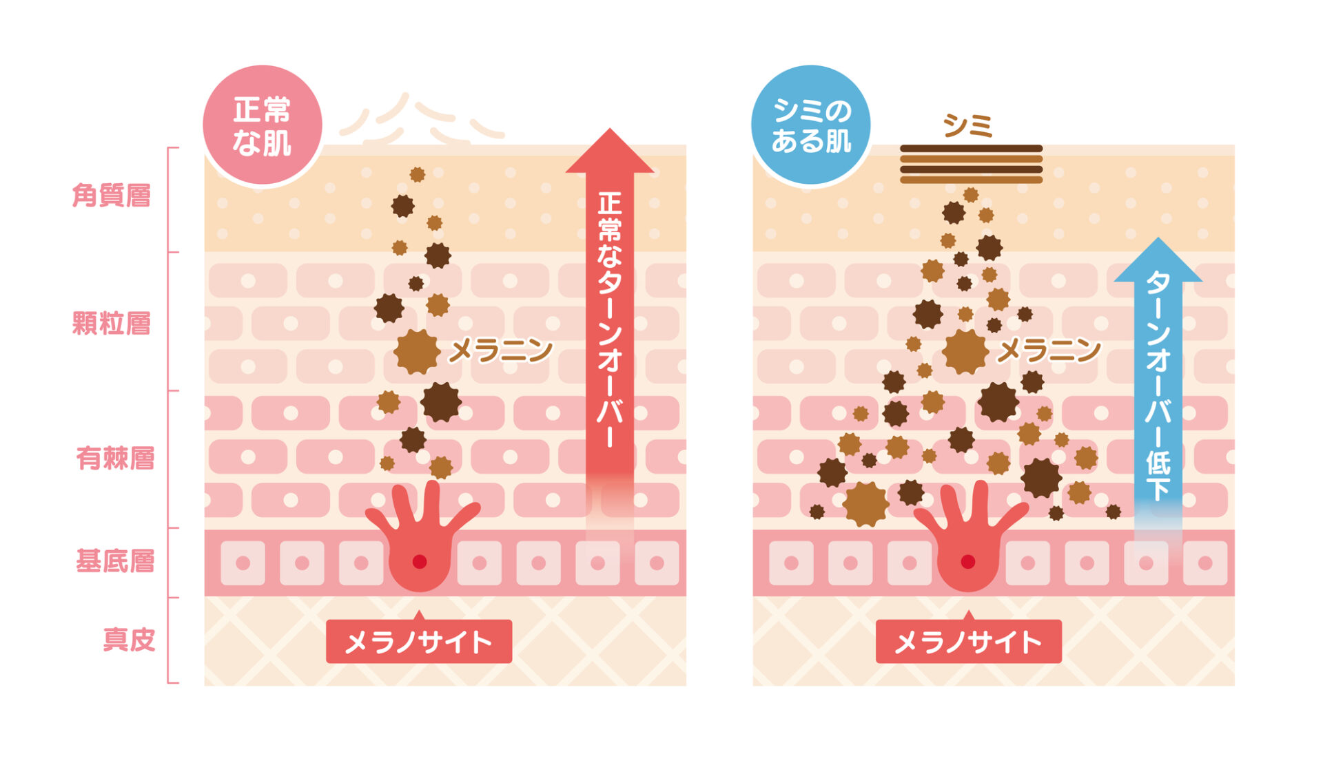 シミ原因