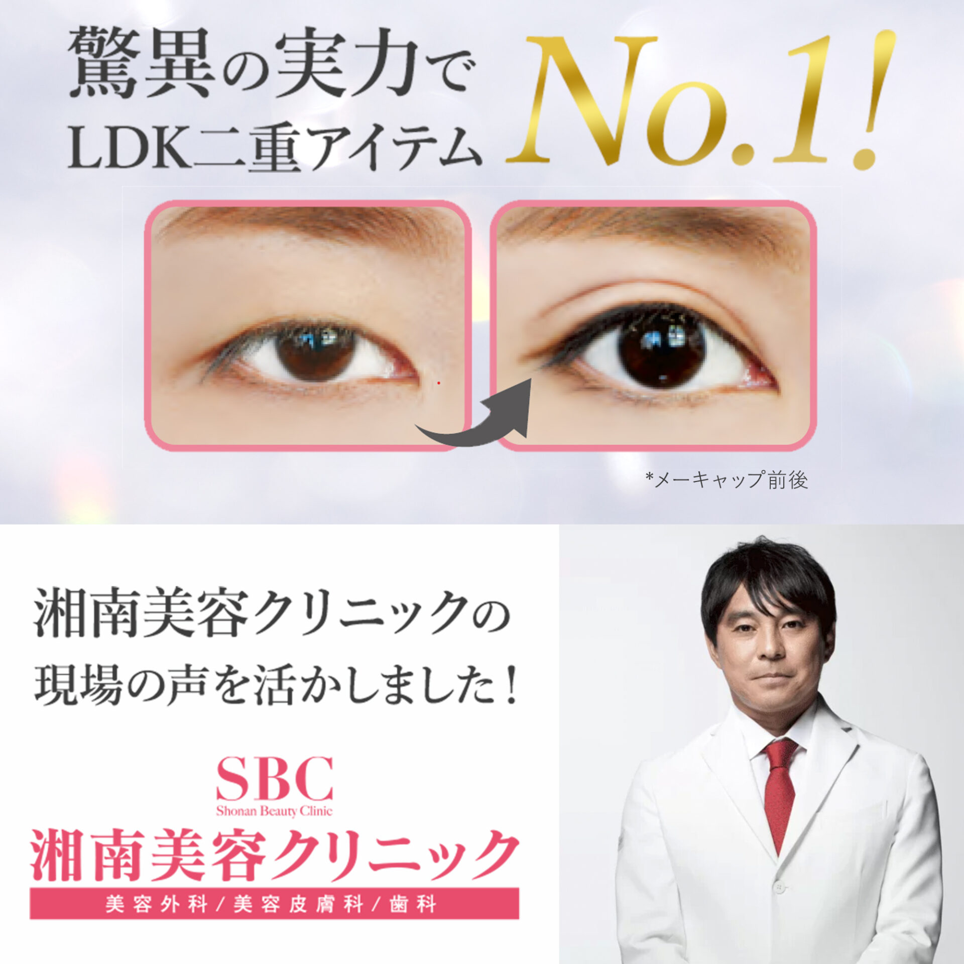 湘南美容アイリッドグルー