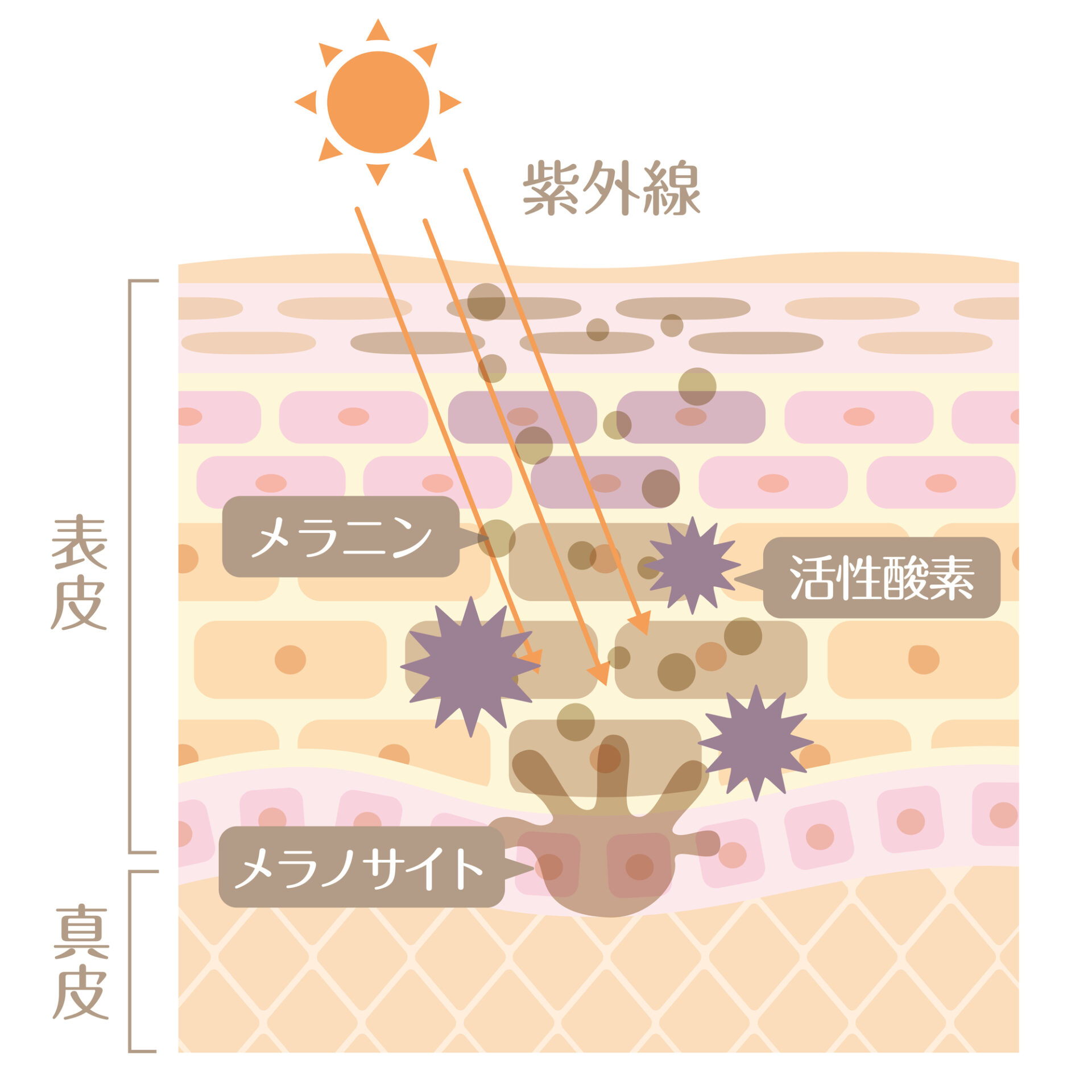 シミ　メカニズム